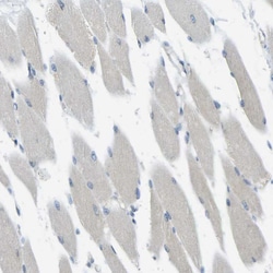 Invitrogen RHBDD1 Polyclonal Antibody 100 &mu;L; Unconjugated:Antibodies,
