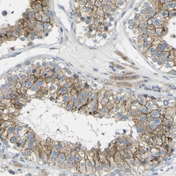 Invitrogen RHBDD1 Polyclonal Antibody 100 &mu;L; Unconjugated:Antibodies,