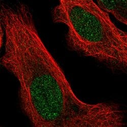 Invitrogen ZBTB46 Polyclonal Antibody 100 &mu;L; Unconjugated:Antibodies,