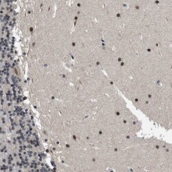 Invitrogen ZBTB46 Polyclonal Antibody 100 &mu;L; Unconjugated:Antibodies,