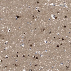 Invitrogen ZBTB46 Polyclonal Antibody 100 &mu;L; Unconjugated:Antibodies,