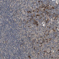 Invitrogen ZBTB46 Polyclonal Antibody 100 &mu;L; Unconjugated:Antibodies,