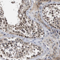 Invitrogen ZBTB46 Polyclonal Antibody 100 &mu;L; Unconjugated:Antibodies,