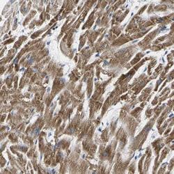 Invitrogen TMEM204 Polyclonal Antibody 100 &mu;L | Buy Online | Invitrogen&trade; | Fisher Scientific