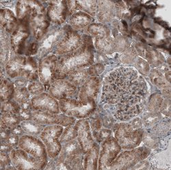 Invitrogen KANK4 Polyclonal Antibody 100 &mu;L; Unconjugated:Antibodies,