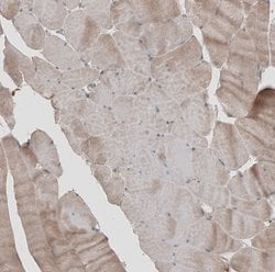 Invitrogen KANK4 Polyclonal Antibody 100 &mu;L; Unconjugated:Antibodies,