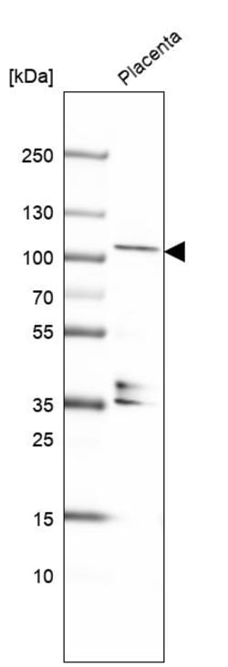 Invitrogen KANK4 Polyclonal Antibody 100 &mu;L | Buy Online | Invitrogen&trade; | Fisher Scientific