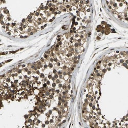 Invitrogen FUT11 Polyclonal Antibody 100 &mu;L; Unconjugated:Antibodies,