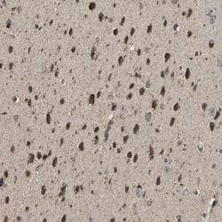 Invitrogen SEC62 Polyclonal Antibody 100 &mu;L; Unconjugated:Antibodies,