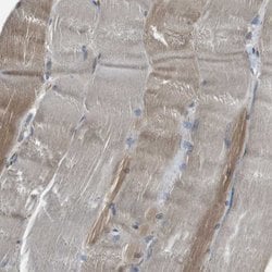 Invitrogen SEC62 Polyclonal Antibody 100 &mu;L; Unconjugated:Antibodies,