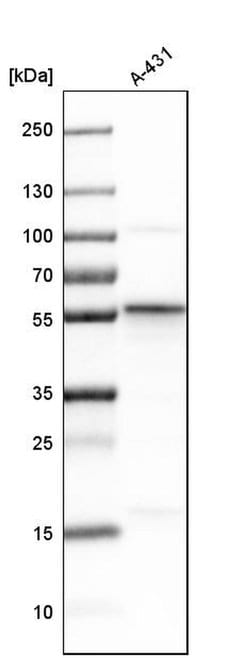 Invitrogen SEC62 Polyclonal Antibody 100 &mu;L; Unconjugated:Antibodies,