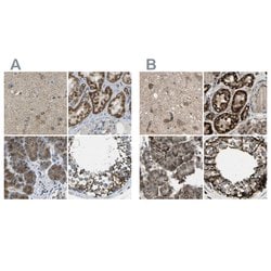 Invitrogen CYB5R1 Polyclonal Antibody 100 &mu;L; Unconjugated:Antibodies,