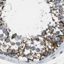 Invitrogen CYB5R1 Polyclonal Antibody 100 &mu;L; Unconjugated:Antibodies,