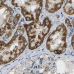 Invitrogen CYB5R1 Polyclonal Antibody 100 &mu;L; Unconjugated:Antibodies,