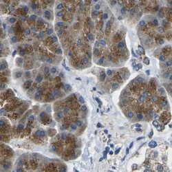 Invitrogen CYB5R1 Polyclonal Antibody 100 &mu;L; Unconjugated:Antibodies,