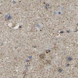 Invitrogen CYB5R1 Polyclonal Antibody 100 &mu;L; Unconjugated:Antibodies,