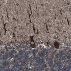 Invitrogen LNP Polyclonal Antibody 100 &mu;L; Unconjugated:Antibodies,