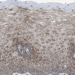 Invitrogen LNP Polyclonal Antibody 100 &mu;L; Unconjugated:Antibodies,
