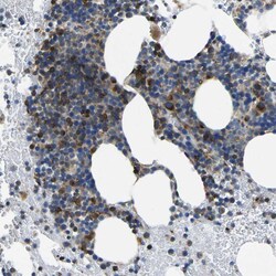 Invitrogen TMCC2 Polyclonal Antibody 100 &mu;L; Unconjugated:Antibodies,