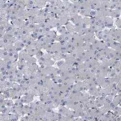 Invitrogen TMCC2 Polyclonal Antibody 100 &mu;L; Unconjugated:Antibodies,