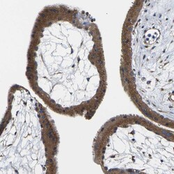 Invitrogen TMCC2 Polyclonal Antibody 100 &mu;L; Unconjugated:Antibodies,