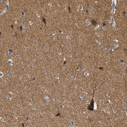 Invitrogen GDAP1 Polyclonal Antibody 100 &mu;L | Buy Online | Invitrogen&trade; | Fisher Scientific