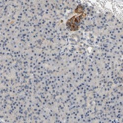 Invitrogen GDAP1 Polyclonal Antibody 100 &mu;L | Buy Online | Invitrogen&trade; | Fisher Scientific