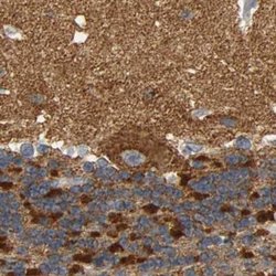 Invitrogen GDAP1 Polyclonal Antibody 100 &mu;L | Buy Online | Invitrogen&trade; | Fisher Scientific