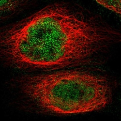Invitrogen KCTD10 Polyclonal Antibody 100 &mu;L; Unconjugated:Antibodies,
