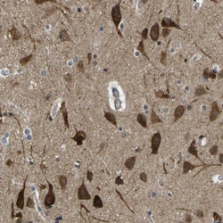 Invitrogen KCTD10 Polyclonal Antibody 100 &mu;L; Unconjugated:Antibodies,