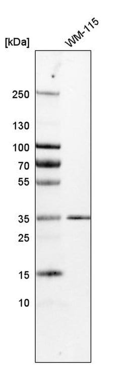 Invitrogen KCTD10 Polyclonal Antibody 100 &mu;L; Unconjugated:Antibodies,