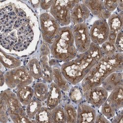 Invitrogen ARHGAP24 Polyclonal Antibody 100 &mu;L; Unconjugated:Antibodies,