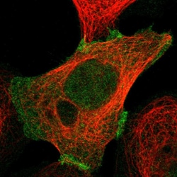 Invitrogen PKP2 Polyclonal Antibody 100 &mu;L; Unconjugated:Antibodies,