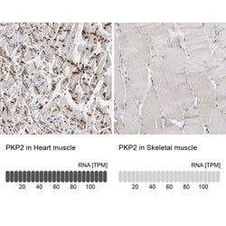 Invitrogen PKP2 Polyclonal Antibody 100 &mu;L; Unconjugated:Antibodies,