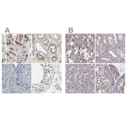 Invitrogen PKP2 Polyclonal Antibody 100 &mu;L; Unconjugated:Antibodies,