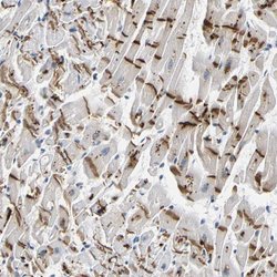Invitrogen PKP2 Polyclonal Antibody 100 &mu;L; Unconjugated:Antibodies,