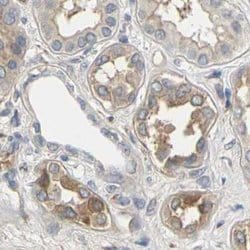 Invitrogen PKP2 Polyclonal Antibody 100 &mu;L; Unconjugated:Antibodies,