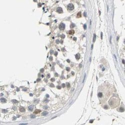 Invitrogen PKP2 Polyclonal Antibody 100 &mu;L; Unconjugated:Antibodies,