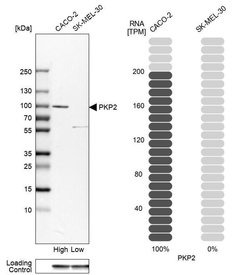 Invitrogen PKP2 Polyclonal Antibody 100 &mu;L; Unconjugated:Antibodies,