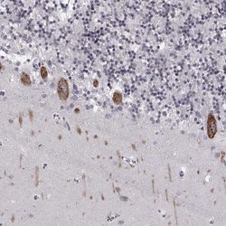 Invitrogen MARCH4 Polyclonal Antibody 100 &mu;L; Unconjugated:Antibodies,