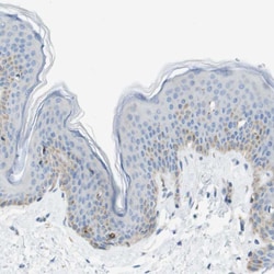 Invitrogen SDR42E1 Polyclonal Antibody 100 &mu;L; Unconjugated:Antibodies,