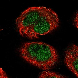Invitrogen TMEM194A Polyclonal Antibody 100 &mu;L; Unconjugated:Antibodies,