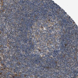 Invitrogen TMEM194A Polyclonal Antibody 100 &mu;L; Unconjugated:Antibodies,