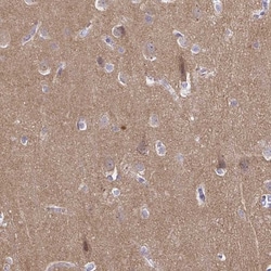 Invitrogen CDH18 Polyclonal Antibody 100 &mu;L; Unconjugated:Antibodies,