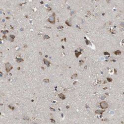 Invitrogen PCNXL2 Polyclonal Antibody 100 &mu;L; Unconjugated:Antibodies,