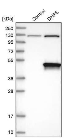 Invitrogen DHPS Polyclonal Antibody 100 &mu;L; Unconjugated:Antibodies,
