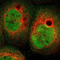 Invitrogen ABHD15 Polyclonal Antibody 100 &mu;L; Unconjugated:Antibodies,