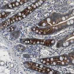 Invitrogen ABHD15 Polyclonal Antibody 100 &mu;L; Unconjugated:Antibodies,
