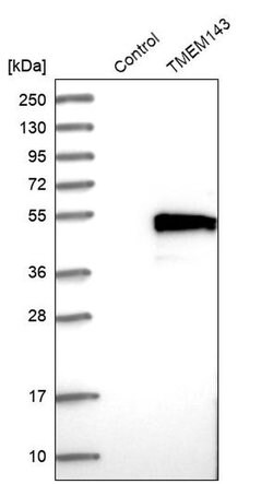Invitrogen TMEM143 Polyclonal Antibody 100 &mu;L; Unconjugated:Antibodies,