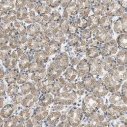 Invitrogen ZDHHC20 Polyclonal Antibody 100 &mu;L; Unconjugated:Antibodies,